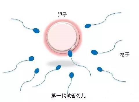 着床前診断 PGT
